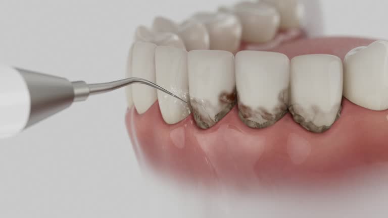 Reliable Dental contractor in Mesa, AZ by Smile Center Dentistry
